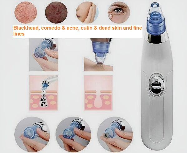 3 in 1 Derma Suction Cell Operated